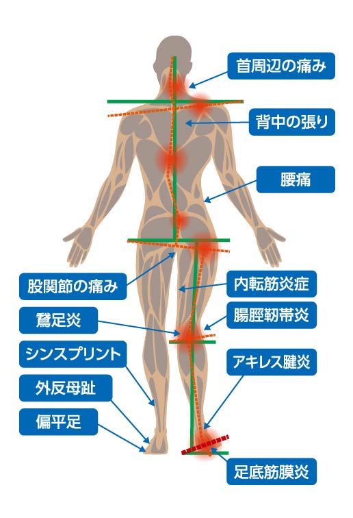 インソール（中敷き）の役割