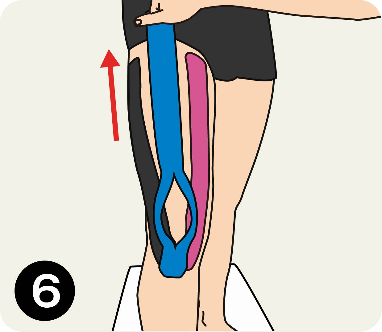 大腿四頭筋へのキネシオテープの巻き方 Mueller Japan