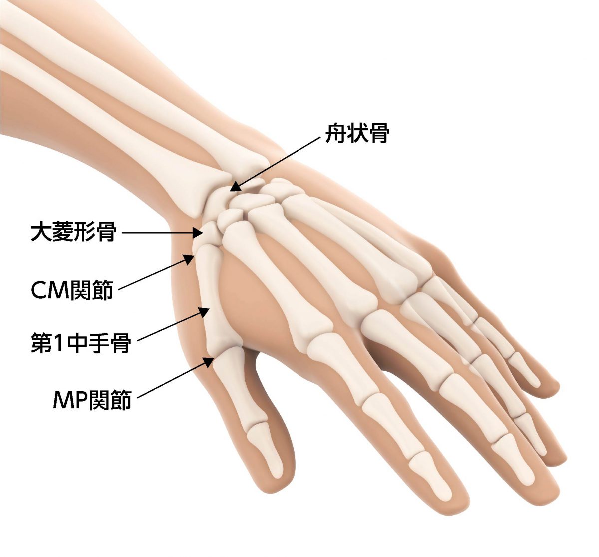 痛い 指 付け根 の 手 の が